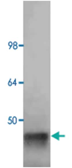 ALDOA Goat anti-Human, Rabbit, Polyclonal Antibody, Abnova 100 &mu;g | Buy Online | Abnova Corporation | Fisher Scientific