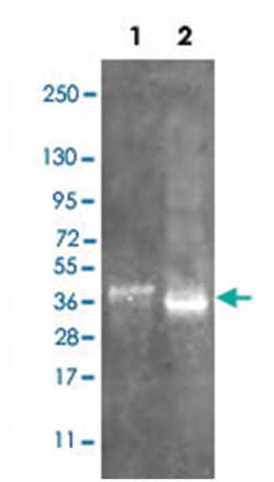 SERPINB14 (OVAL), Rabbit, Polyclonal Antibody, Abnova 100&mu;g; Unlabeled:Antibodies,