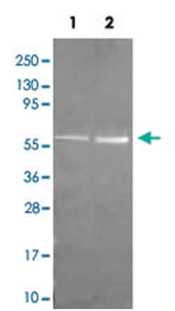 CAT Rabbit anti-Bovine, Human, Mouse, Rat, Sheep, Polyclonal Antibody, Abnova 100 &mu;g | Buy Online | Abnova Corporation | Fisher Scientific