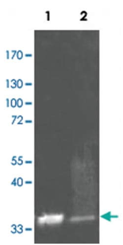 KTI3 (soybean), Rabbit, Polyclonal Antibody, Abnova 100&mu;g; Unlabeled:Anticuerpos