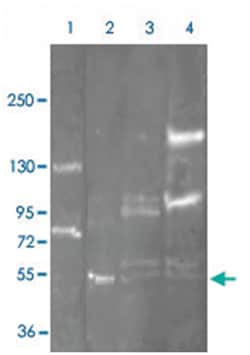 ADA (Bovine), Rabbit, Polyclonal Antibody, Abnova 100 &mu;g | Buy Online | Abnova Corporation | Fisher Scientific