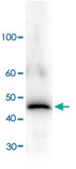 adh1, Rabbit, Polyclonal Antibody, Abnova 100&mu;g; Unlabeled:Antibodies,