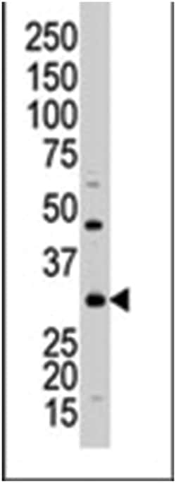 STK16, Rabbit, Polyclonal Antibody, Abnova 400 &mu;L | Buy Online | Abnova Corporation | Fisher Scientific