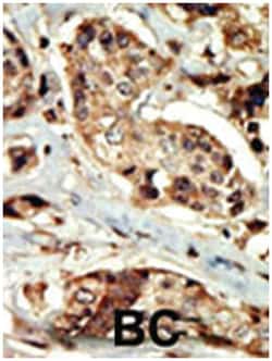 STK16, Rabbit, Polyclonal Antibody, Abnova 400 &mu;L | Buy Online | Abnova Corporation | Fisher Scientific