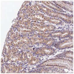 WDR5B, Rabbit, Polyclonal Antibody, Abnova 100 &mu;L | Buy Online | Abnova | Fisher Scientific