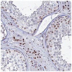 GSC2 Rabbit anti-Human, Polyclonal Antibody, Abnova 100&mu;L; Unlabeled:Antibodies,
