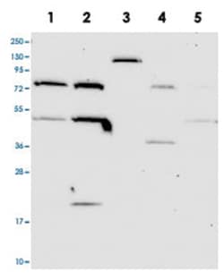 THUMPD2, Rabbit, Polyclonal Antibody, Abnova 100 &mu;L | Buy Online | Abnova Corporation | Fisher Scientific