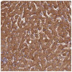 THUMPD2, Rabbit, Polyclonal Antibody, Abnova 100 &mu;L | Buy Online | Abnova Corporation | Fisher Scientific