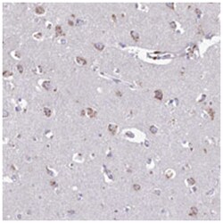 HS2ST1 Rabbit anti-Human, Polyclonal Antibody, Abnova 100 &mu;L | Buy Online | Abnova Corporation | Fisher Scientific