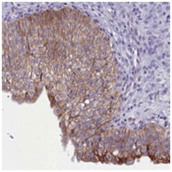 TACSTD2, Rabbit, Polyclonal Antibody, Abnova 100 &mu;L | Buy Online | Abnova Corporation | Fisher Scientific