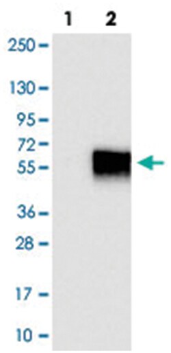 TACSTD2, Rabbit, Polyclonal Antibody, Abnova 100 &mu;L | Buy Online | Abnova Corporation | Fisher Scientific