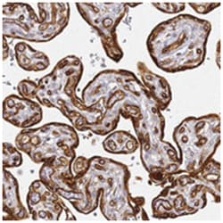 KIF7, Rabbit, Polyclonal Antibody, Abnova 100&mu;L; Unlabeled:Antibodies,