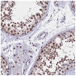 CCDC97 Rabbit anti-Human, Polyclonal Antibody, Abnova 100 &mu;L | Buy Online | Abnova Corporation | Fisher Scientific