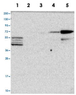 CLIP4 Rabbit anti-Human, Polyclonal Antibody, Abnova 100 &mu;L | Buy Online | Abnova Corporation | Fisher Scientific