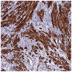 CLIP4 Rabbit anti-Human, Polyclonal Antibody, Abnova 100 &mu;L | Buy Online | Abnova Corporation | Fisher Scientific