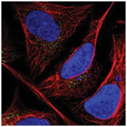 CLIP4 Rabbit anti-Human, Polyclonal Antibody, Abnova 100 &mu;L | Buy Online | Abnova Corporation | Fisher Scientific