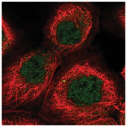 OSBPL1A Rabbit anti-Human, Polyclonal Antibody, Abnova 100&mu;L; Unlabeled:Antibodies,