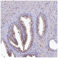CAPN12, Rabbit, Polyclonal Antibody, Abnova 100 &mu;L | Buy Online | Abnova Corporation | Fisher Scientific