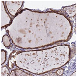AGGF1 Rabbit anti-Human, Polyclonal Antibody, Abnova 100 &mu;L | Buy Online | Abnova Corporation | Fisher Scientific