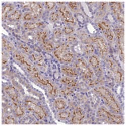 ANKS4B, Rabbit, Polyclonal Antibody, Abnova 100 &mu;L | Buy Online | Abnova Corporation | Fisher Scientific