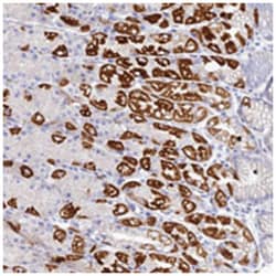 DHX34 Rabbit anti-Human, Polyclonal Antibody, Abnova 100 &mu;L | Buy Online | Abnova Corporation | Fisher Scientific
