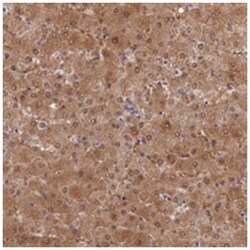 SLC25A41, Rabbit, Polyclonal Antibody, Abnova 100&mu;L; Unlabeled:Antibodies,