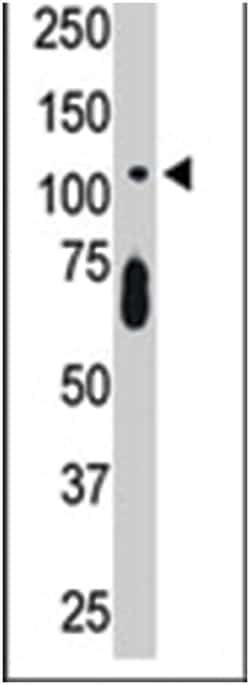CDKL5, Rabbit, Polyclonal Antibody, Abnova 400 &mu;L | Buy Online | Abnova Corporation | Fisher Scientific