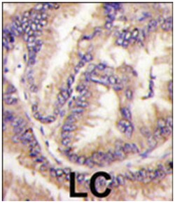 CDKL5, Rabbit, Polyclonal Antibody, Abnova 400 &mu;L | Buy Online | Abnova Corporation | Fisher Scientific