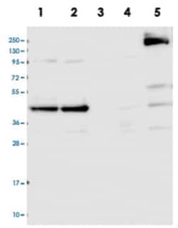 CCDC94, Rabbit, Polyclonal Antibody, Abnova 100 &mu;L | Buy Online | Abnova Corporation | Fisher Scientific