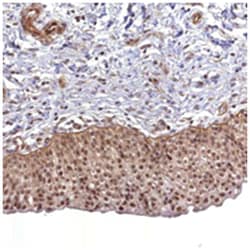 CCDC94, Rabbit, Polyclonal Antibody, Abnova 100 &mu;L | Buy Online | Abnova Corporation | Fisher Scientific