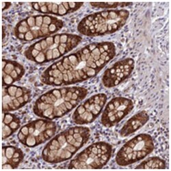 EARS2 Rabbit anti-Human, Polyclonal Antibody, Abnova 100 &mu;L | Buy Online | Abnova Corporation | Fisher Scientific