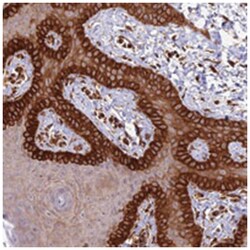 COL17A1, Rabbit, Polyclonal Antibody, Abnova 100&mu;L; Unlabeled:Antibodies,