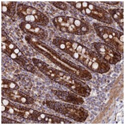 C6orf221, Rabbit, Polyclonal Antibody, Abnova 100&mu;L; Unlabeled:Antibodies,