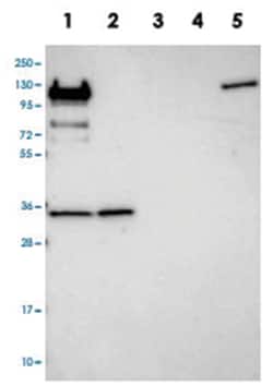 RPL5 Rabbit anti-Human, Polyclonal Antibody, Abnova 100&mu;L; Unlabeled:Antibodies,