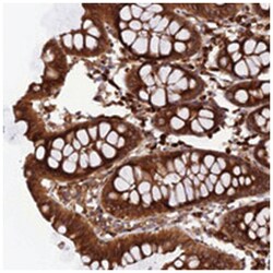 RLN3 Rabbit anti-Human, Polyclonal Antibody, Abnova 100&mu;L; Unlabeled:Antibodies,