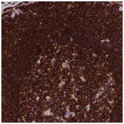 PTPRCAP, Rabbit, Polyclonal Antibody, Abnova 100 &mu;L | Buy Online | Abnova Corporation | Fisher Scientific