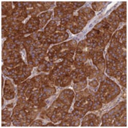 TMEM144, Rabbit, Polyclonal Antibody, Abnova 100 &mu;L | Buy Online | Abnova Corporation | Fisher Scientific