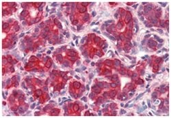 GM2A, Rabbit, Polyclonal Antibody, Abnova 50&mu;g; Unlabeled:Antibodies,