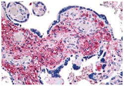 NET1 Rabbit anti-Human, Polyclonal Antibody, Abnova 50 &mu;g | Buy Online | Abnova Corporation | Fisher Scientific