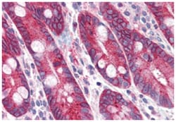 PIGR, Rabbit, Polyclonal Antibody, Abnova 50 &mu;g | Buy Online | Abnova Corporation | Fisher Scientific