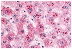 Abnova Corporation PYGL Rabbit anti-Human, Monkey, Polyclonal Antibody, Abnova™