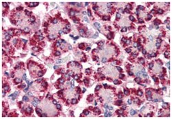 STEAP4 Rabbit anti-Human, Polyclonal Antibody, Abnova 50 &mu;g | Buy Online | Abnova Corporation | Fisher Scientific