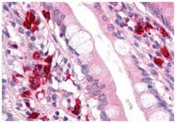 TFF2 Rabbit anti-Human, Polyclonal Antibody, Abnova 50 &mu;g | Buy Online | Abnova Corporation | Fisher Scientific