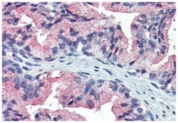 TM9SF3 Rabbit anti-Bovine, Chicken, Dog, Guinea pig, Horse, Human, Monkey, Mouse, Pig, Rabbit, Rat, Polyclonal Antibody, Abnova 50 &mu;g | Buy Online | Abnova Corporation | Fisher Scientific