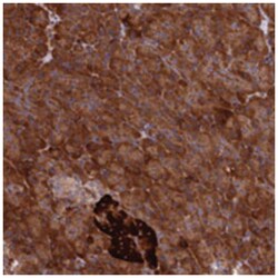 DDX60L, Rabbit, Polyclonal Antibody, Abnova 100 &mu;L | Buy Online | Abnova Corporation | Fisher Scientific