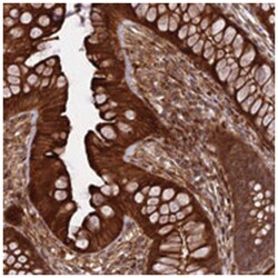 PHLDB3, Rabbit, Polyclonal Antibody, Abnova 100&mu;L; Unlabeled:Antibodies,