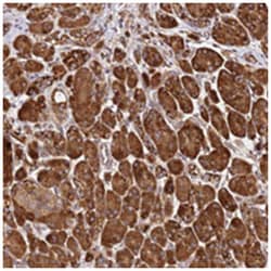 ALG11, Rabbit, Polyclonal Antibody, Abnova 100 &mu;L | Buy Online | Abnova Corporation | Fisher Scientific