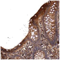LOC100131755, Rabbit, Polyclonal Antibody, Abnova 100 &mu;L | Buy Online | Abnova Corporation | Fisher Scientific