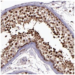 WASH6P, Rabbit, Polyclonal Antibody, Abnova 100&mu;L; Unlabeled:Antibodies,