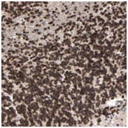 C14orf38, Rabbit, Polyclonal Antibody, Abnova 100 &mu;L | Buy Online | Abnova Corporation | Fisher Scientific